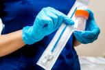 Penyebab Kanker Serviks pada Wanita Faktor Risiko Human Papillomavirus dan Pencegahannya